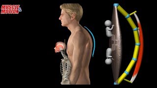 Myofacia approach for forwardhead posture [upl. by Mohkos]