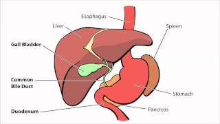 Biliary Atresia  What is Biliary Atresia [upl. by Shelburne162]