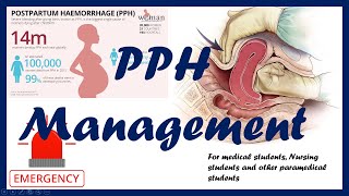 Post Partum Haemorrhage PPH Management  RCOG guidelines Educational guide [upl. by Glenna]