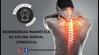 Ressonância Magnética da Coluna Dorsal Torácica [upl. by Gnouhp755]