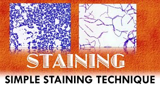 Simple staining technique  Principle  Procedure and Applications  Microbiological Insights [upl. by Moynahan454]