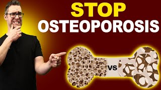 Top 7 Osteopenia amp Osteoporosis Treatments Symptoms amp Medications [upl. by Ennyletak]