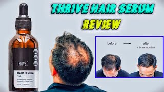 Thrive Hair serum Review After 3 months  Best Serum for hairfall and Hair loss [upl. by Nnairrehs442]