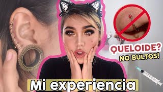 MIS PIERCINGS  EXPERIENCIA l QUELOIDES Como quitarlos Septum Medusa Nostril piercing oreja [upl. by Philipson]