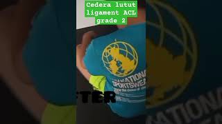 Cedera lutut ligament ACL grade 2 karena main futsal [upl. by Freytag]