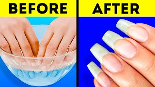 26 AWESOME NAIL HACKS YOU WILL DEFINITELY LIKE [upl. by Thorman]