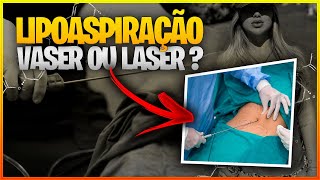 🩸LIPOASPIRAÇÃO VASER OU LASER  Qual melhor opção de Lipoaspiração [upl. by Lucienne482]