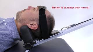 Neck Decompression Machine  Cervical Mechanical Traction [upl. by Onek]