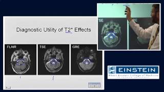 Introducing MRI MR Imaging of Hemorrhage 52 of 56 [upl. by Wilkison]