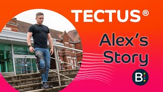 Tectus® Case Study Alex ExMilitary Extended [upl. by Bechler]