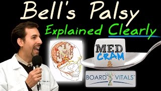 Bell’s palsy vs facial paralysis what’s the difference [upl. by Harriman]