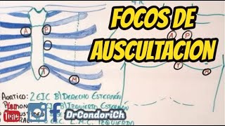 Focos de auscultación cardiaco facil y sencillo [upl. by Rudy]