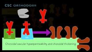 Central Serous Chorioretinopathy Part 3 [upl. by Anirt]