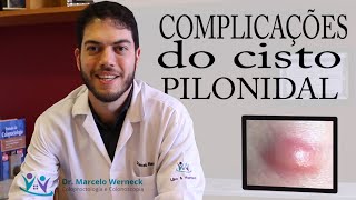 Complicações do cisto pilonidal  Dr Marcelo Werneck [upl. by Tsenre]