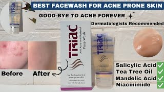 BEST FACE WASH FOR ACNEPRONE SKIN TRIAC FACE WASH HONEST REVIEW [upl. by Odraccir]