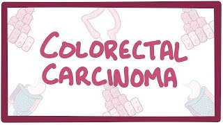 Colorectal carcinoma  causes symptoms diagnosis treatment pathology [upl. by Eduino]