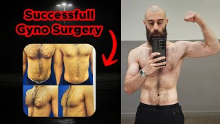 My Entire Gynecomastia Surgery Experience Plus Dos amp Donts [upl. by Moishe]