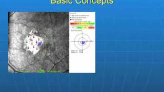 Introduction to Microperimetry [upl. by Torrey]