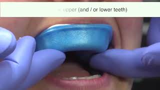 GC Tooth Mousse  How To Use  DENTBEAR [upl. by Yssirc]