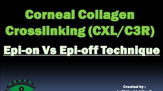 CORNEAL COLLAGEN CROSSLINKING EPION Vs EPIOFF TECHNIQUE HD [upl. by Lairret327]