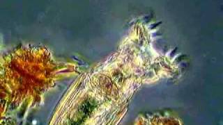 Rotifer Feeding II [upl. by Saxena]