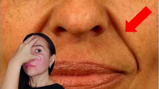 7 effective MASSAGE techniques to reduce NASOLABIAL FOLDS SMILE LINES [upl. by Rufford]