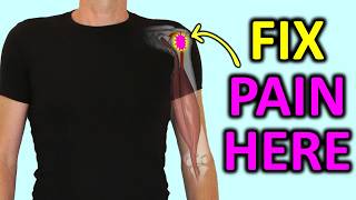 Front Shoulder Pain Fix the REAL cause of Biceps Tendonitis [upl. by Palladin250]