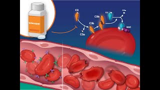 Iptacopan for Paroxysmal Nocturnal Hemoglobinuria  NEJM [upl. by Nappie385]