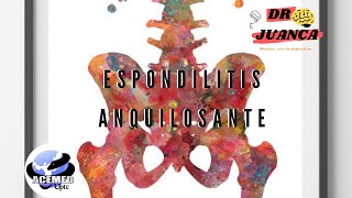 Espondilitis Anquilosante ACEMED UPTC [upl. by Fachanan]