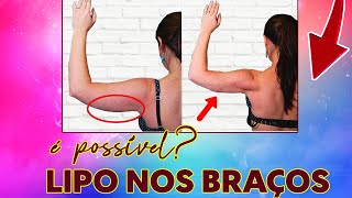 LIPO LAD NOS BRAÇOS É POSSÍVEL [upl. by Jessamine]