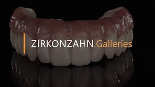 Removable Prettau® Bridge on six implants  ZirkonzahnGalleries [upl. by Tiler]