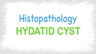 Hydatid Cyst histopathology features [upl. by Odlareg]