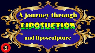 A journey through liposuction and liposculpture Part 310 [upl. by Nee909]