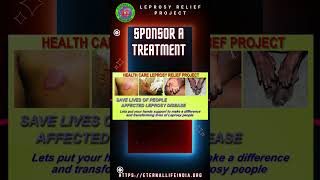 SPONSOR A TREATMENT FOR LEPROSY [upl. by Zerimar]