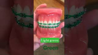 Light Green BRACES tooth vlog orthodonticsviral shortsbraces [upl. by Acimaj563]