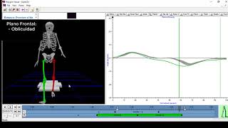Cinemática de la pelvis durante la marcha [upl. by Ahsitil324]