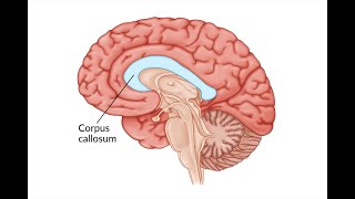 Section of the corpus Callosum and effect on left and right visual field [upl. by Shepherd]