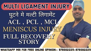 Multi LIGAMENTACLPCLMCL amp MENISCUS INJURY FULL RECOVERY STORYDr Shekh M Khan kneeligament acl [upl. by Solley]