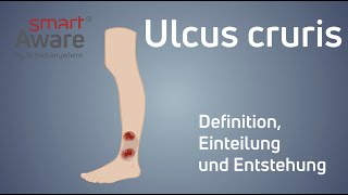 Ulcus cruris Definition Einleitung und Entstehung  Wundmanagement in der Pflege  smartAware [upl. by Irac460]