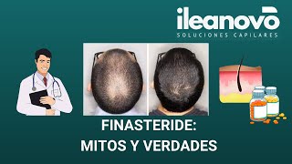 TODO sobre el FINASTERIDE  MITOS y VERDADES [upl. by Amsirak]