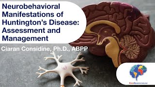 Neurobehavioral Manifestations of Huntington’s Disease Assessment and Management [upl. by Llemar550]