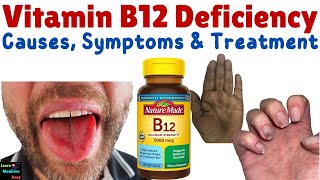 Vitamin B12 Deficiency – Symptoms Causes Diagnosis Treatment amp Prevention  Cobalamin Deficiency [upl. by Adnohsed252]