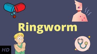 Ringworm Causes Signs and Symptoms Diagnosis and Treatment [upl. by Hardunn68]