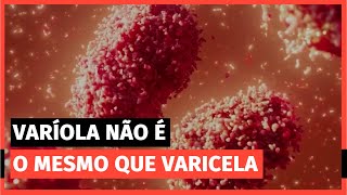 VARÍOLA É A MESMA VARICELA [upl. by Rahmann]