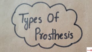 Types of ProsthesisBodyPowered Prosthesis Externally Powered ProsthesisMyoelectric Prosthesis [upl. by Benny]