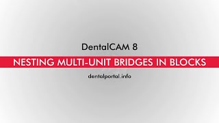 DentalCAM 8 – Multi unit bridges in blocks [upl. by Avrenim]