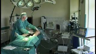 Endovenous Laserocclusion EVLO with Venex by KLS Martin part 1 [upl. by Abra]