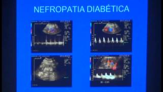 Qual a contribuição do Doppler nas I Renais e Estenoses da Artéria Renal  Carlos Stéfano [upl. by Nois]