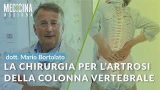 La chirurgia per lartrosi della colonna vertebrale  Dott Mario Bortolato [upl. by Phenice380]