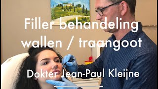 Wallen traangoot en donkere kringen met fillers  Art de la Beauté  Dokter JeanPaul Kleijne [upl. by Redyr551]